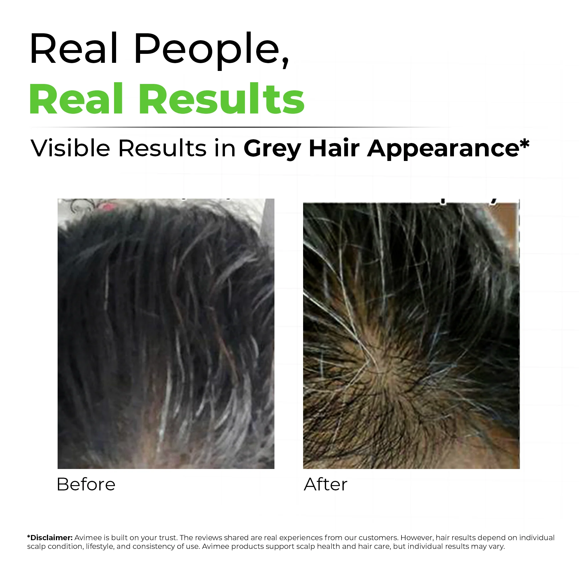Scalptone Grey Hair Serum - Image 4