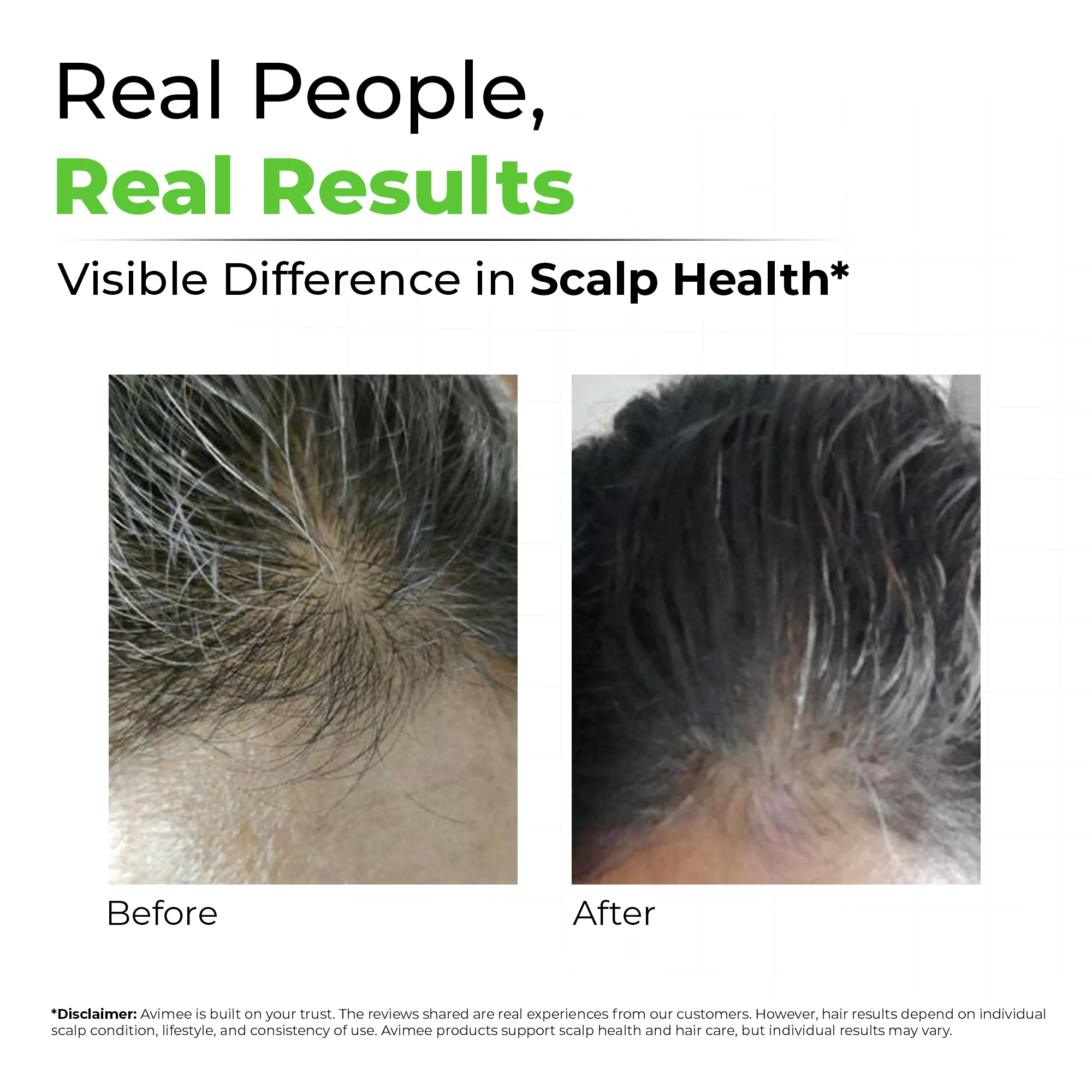 Keshkrishna Grey Hair Oil - Image 4