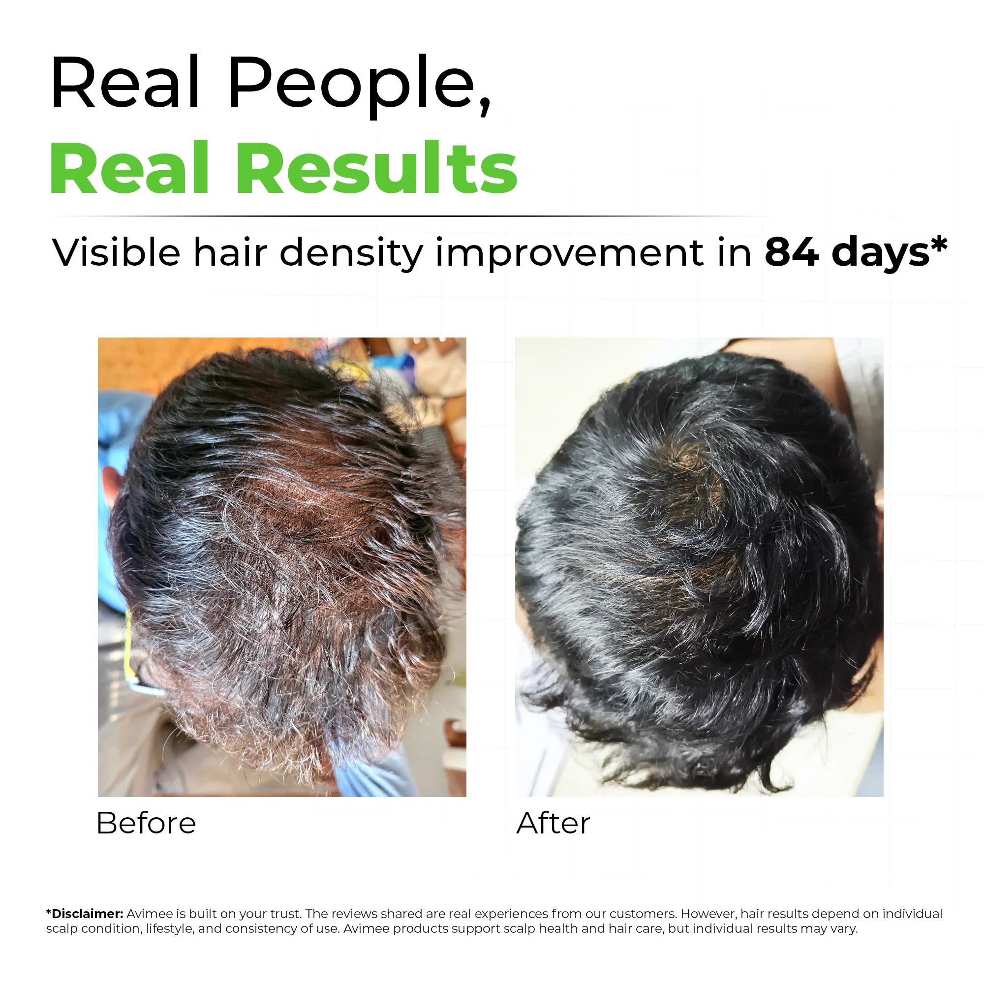 Rosemary Water for Hair - Image 3
